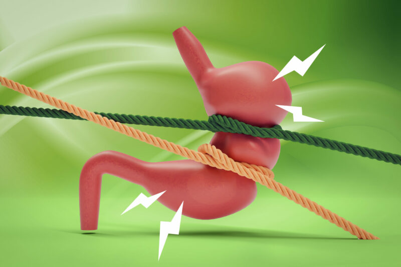 Understanding and managing Irritable Bowel Syndrome